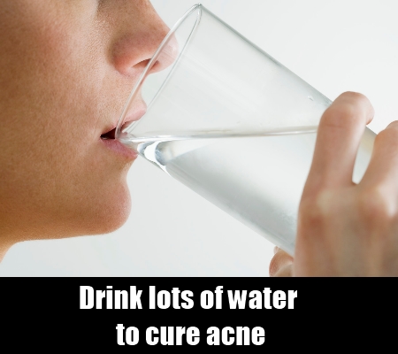 Fast Acne Home Remedy