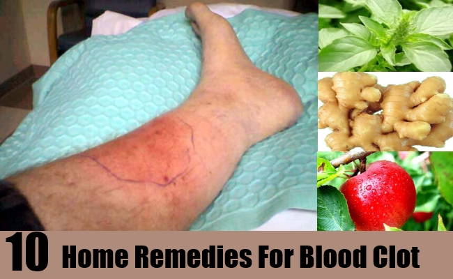 10 Home Remedies For Blood Clots Natural Home Remedies Supplements