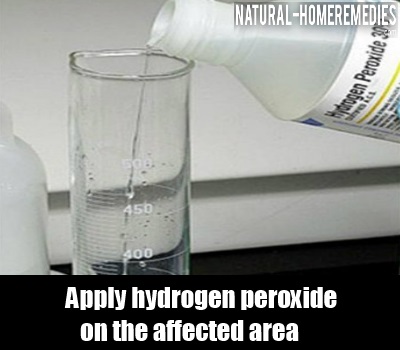 hydrogen natural peroxide taking shower hot poison remedies oak