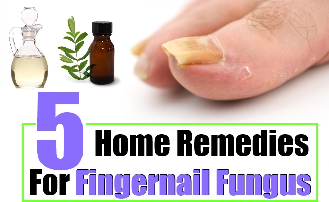 5-home-remedies-for-fingernail-fungus-natural-home-remedies-supplements