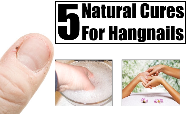 5-beneficial-natural-cures-for-hangnails-natural-home-remedies