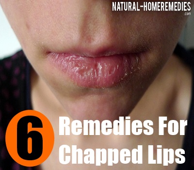 Simple Home Remedies For Chapped Lips - Natural Treatments And Cures ...