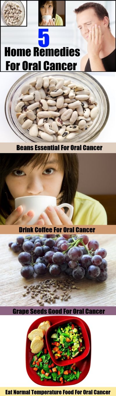 Top 5 Home Remedies For Oral Cancer Natural Treatments And Cure For