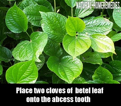 5 Home Remedies For Abscess Tooth - Natural Treatments & Cures ...