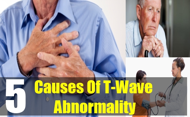 5 Causes Of T-Wave Abnormality